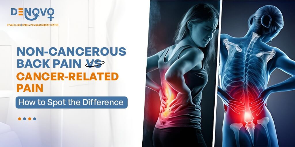 Non-Cancerous Back Pain Vs Cancer-Related Pain